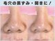 ロエヴェ(ROEWE)の写真/新聞にも取材された毛穴と素肌の専門店!施術実績10万人超!一人ひとりに合わせたケアで理想の素肌を目指す!