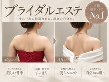 カシェット(cachette)