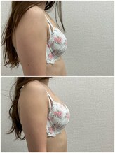 バーディー(BIRDIE)/施術1回/30代