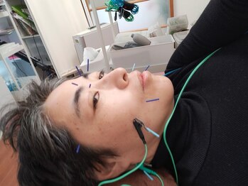 鍼灸院凪/カリム(Calme)/セルフで・・・