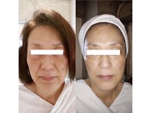 ラヴィアンローズ(La vie en Rose)/持ちが良いと評判の筋膜リリース