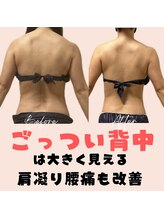 サロン ド ボーテ ラーンジュ 岐阜店(salon de beaut'e L'ange)/ハイパ-ナイフEX2ダイエット痩身