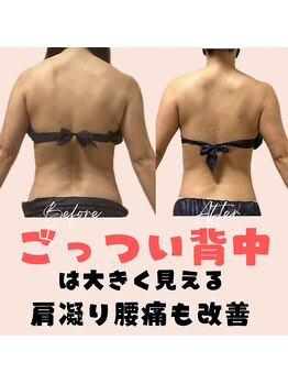 サロン ド ボーテ ラーンジュ 岐阜店(salon de beaut'e L'ange)/ハイパ-ナイフEX2ダイエット痩身