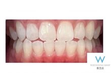 ホワイトニングショップ 奈良香芝店(Whitening shop)