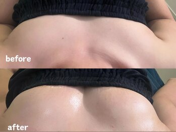 エムプリュ 心斎橋店(M.plus)/スタンダードバスト