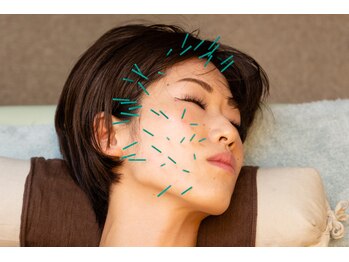 北梅田美容鍼灸院/【大阪/梅田】美容鍼灸