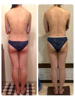 リブラザバランス(LIBRA the balance)/月一ケアでも継続すると変化