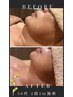 【韓国発☆脂肪分解】レモンボトル2cc(マッサージ＋美肌パック付)13,200円
