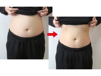 ココ(Coco)/脂肪冷却