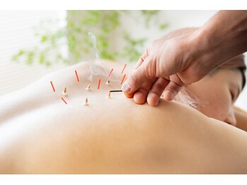 イエジ 浦和(Yeji)/◆鍼灸◆代表カヤマ