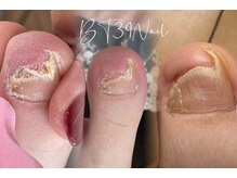 ビーティーサンキューネイル(BT39_Nail)/