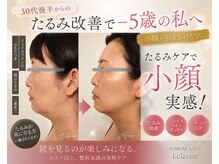 エクラヴィ(Eclatvie)