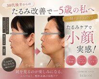 エクラヴィ(Eclatvie)