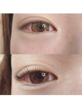 エイミー(eimy)/アディクトカール