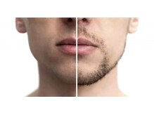 リーム オーガニックビューティー(REAM organic beauty)/男性の髭悩みは脱毛でもう卒業！