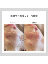 ポムハヌル(pom.haneul)/韓国肌管理室