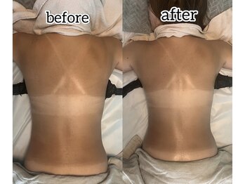 トータルビューティーアンドウィズ(total beauty&WITH)/スリムムーブで浮腫み取り