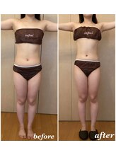 アンフィニ(infini)/ブライダルコース7回目（3ヶ月）