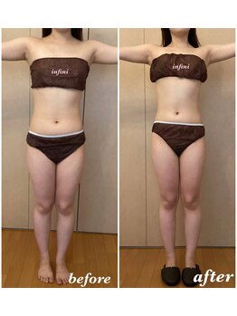 アンフィニ(infini)/ブライダルコース7回目(3ヶ月)