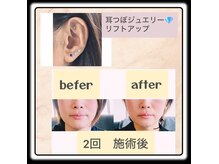 ネオ(Neo)の雰囲気（大好評☆耳つぼジュエリーリフトアップ）