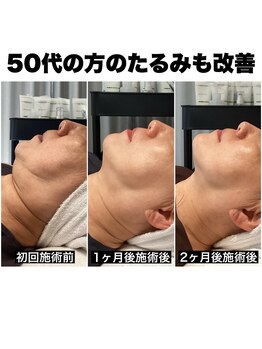 リシェ 市川(riche)/