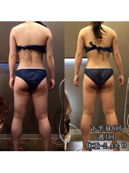 カルム エ コンポーゼ(Calme et Compose')/痩身セルゼロ/下半身6回