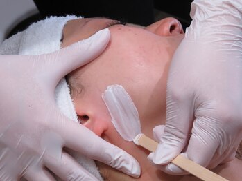 ユウユウ(YUYU)/全顔WAX脱毛