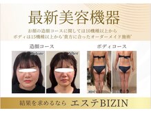 ビジン 名古屋駅前店(BIZIN)の雰囲気（結果を求める方に！痩身プログラム☆小顔もお任せ★）