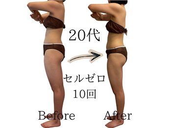 ニコ(nico)/nico/セルライトゼロ/痩身