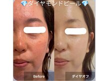 ラ メール(La mer)の雰囲気（ダイヤモンドピール☆お肌の土台ケアでなめらかな輝く艶肌に!）