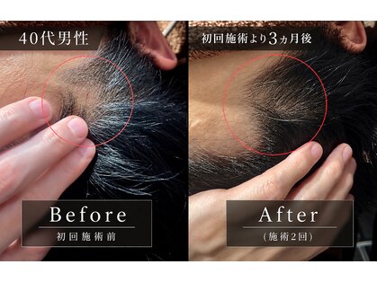 ヘッドサイエンス(HEADSCIENCE)の写真