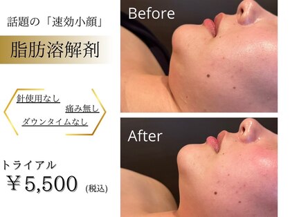 クイーンズ ピュア 新宿本店(Queen's Pure)の写真