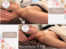 マリスステラ 天王寺(MarisStella)/フェイシャルで二の腕もキュッ！