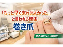 巻き爪じゅん 船橋店/もっと早く来ればよかった。。