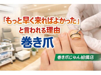 巻き爪じゅん 船橋店/もっと早く来ればよかった。。