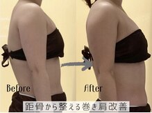 グランツ(glanz)/巻き肩・猫背改善｜距骨整体