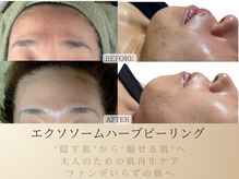 スカイ(sky)の雰囲気（ノーファンデでも輝く艶肌へ。小顔×肌質、同時に叶う）