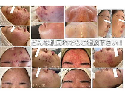 プランス 博多店(PLANCE)の写真