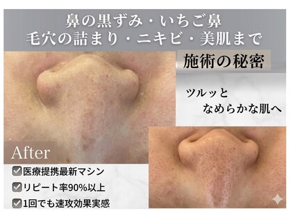 イノエ(inoe)の写真