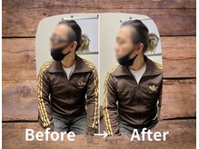 整体院プリュ/Before→ After［13］