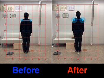 仁 久喜院(JIN)/#骨盤矯正#骨盤の歪み#骨盤ズレ