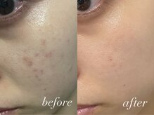 フェイン 青山店(fein.)/後にも効果的です！