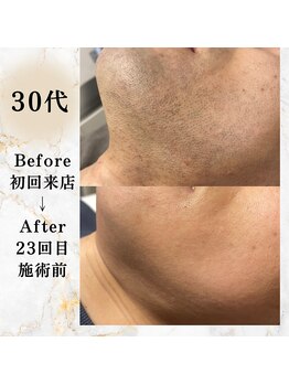 コミチ(KOMICHI)/ビフォーアフター