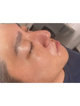 メンズフェイシャル