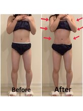 スペチアーレ 夙川/お顔もボディもお悩み解決