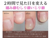 グレースレディ 大阪店の雰囲気（一回の施術で美しい爪へ【自爪育成/長さ出し/深爪/フィルイン】）