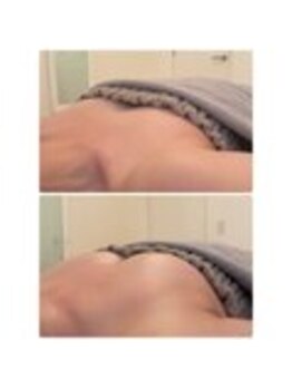 美人バスト 表参道店/【バストアップ/育乳 症例】