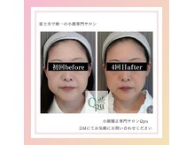 キュープ 富士店(Qpu)の雰囲気（寝落ちできるほど気持ちのいい唯一無二の施術です！小顔/富士市）
