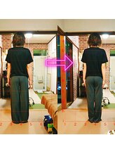 サプライズ整体院/20代ママさんの産後の骨盤初回