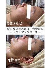 リシェカ(Richeka)/お顔フェイシャル1回の変化